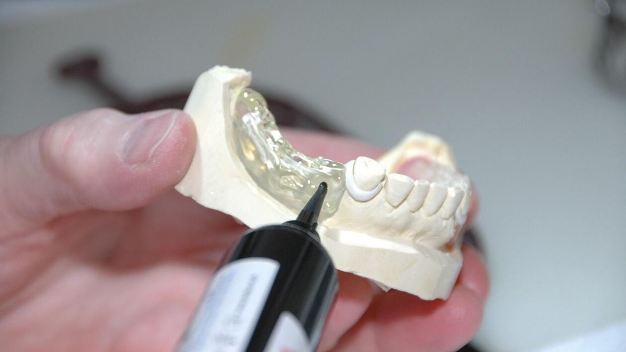 Zur hilfreichen Unterstützung bei der Auswahl von geeigneter Prothetik und passenden Materialien, kann auch ein Zahnersatz-Berater beitragen.