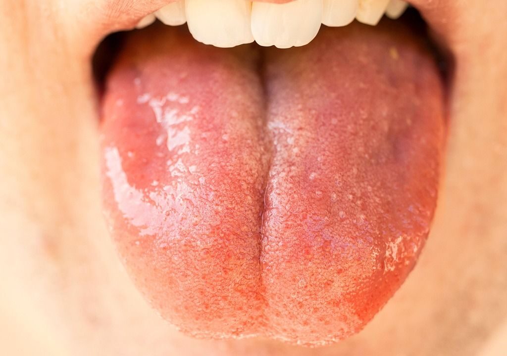 Ausreichender Speichelfluss, eine gesunde Mundflora und regelmäßige zahnmedizinische Prophylaxe sind wichtig für die Mundgesundheit.